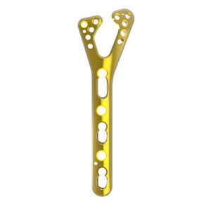 plaque de compression de radius