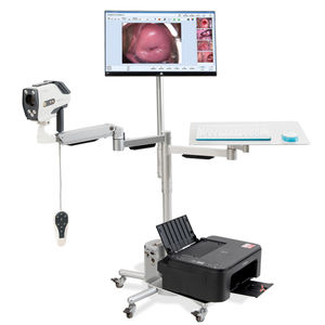 colposcope vidéo