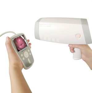 colposcope vidéo