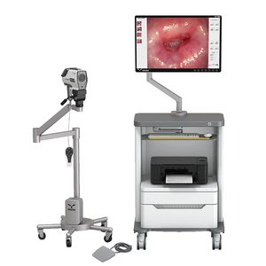 colposcope vidéo