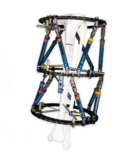 fixateur externe de tibia