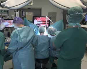 colposcope vidéo