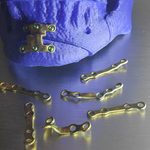 plaque de compression génioplastie