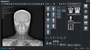 module logiciel de radiographie