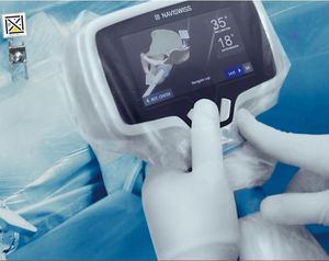 système de navigation chirurgicale pour chirurgie orthopédique