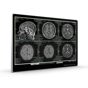 écran pour imagerie médicale