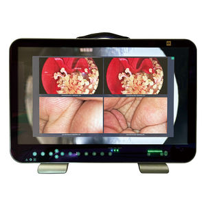 caméra vidéo pour endoscopes