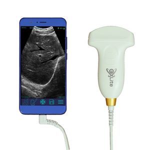 sonde d'échographie convexe