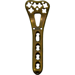 plaque de compression de radius