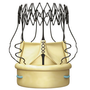 bioprothèse valvulaire aortique