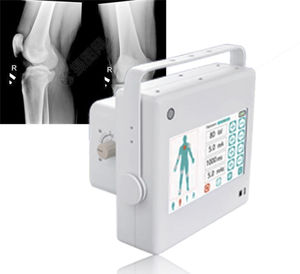 générateur de rayons X pour radiographie polyvalente