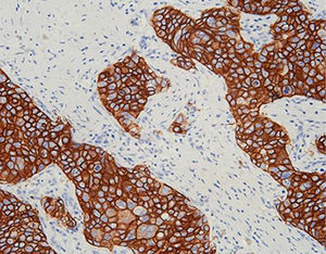 anticorps monoclonal