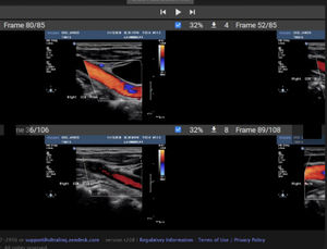 PACS pour imagerie médicale