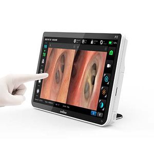 processeur vidéo d'endoscopie
