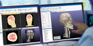 logiciel pour imagerie médicale