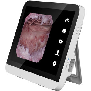 processeur vidéo d'endoscopie