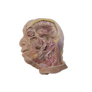 modèle anatomique de tête