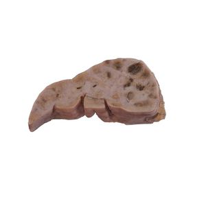 modèle anatomique de foie