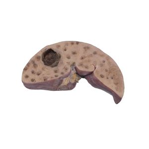 modèle anatomique de foie
