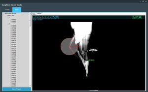 logiciel de visualisation DICOM