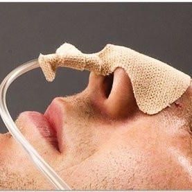 fixateur pour cathéter sonde naso-gastrique
