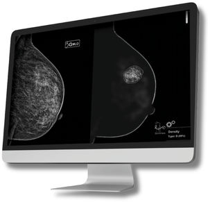 logiciel médical pour tomosynthèse mammaire