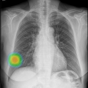 logiciel de radiographie