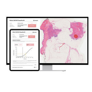 logiciel pour dépistage du cancer du sein