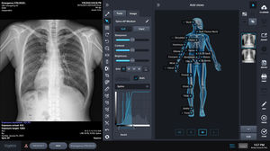 logiciel de radiographie