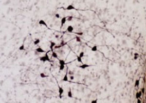 réactif ocytocine