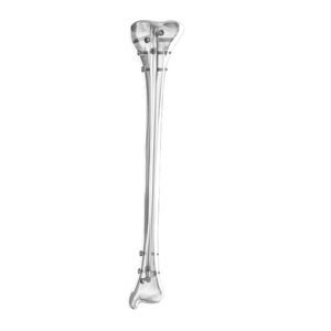 clou intramédullaire de tibia