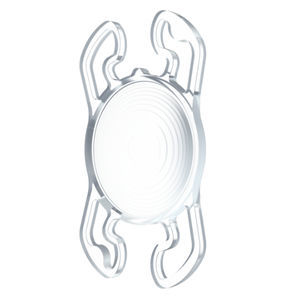lentille intraoculaire torique