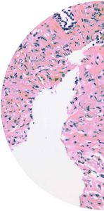 kit de test du cancer de la vessie