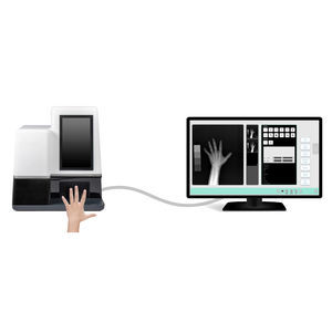 système de radiographie
