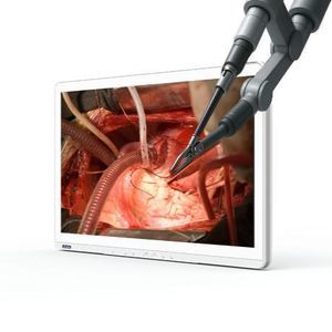 écran d'endoscopie
