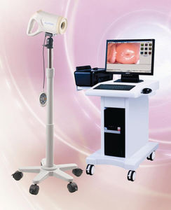 colposcope vidéo