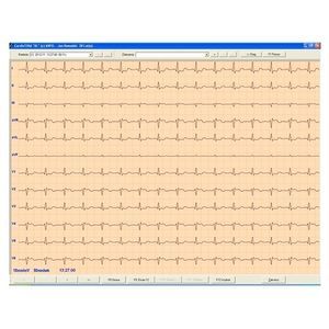 logiciel d'électrocardiographie