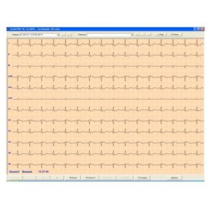 logiciel d'électrocardiographie