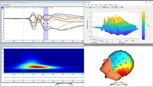 logiciel pour EEG