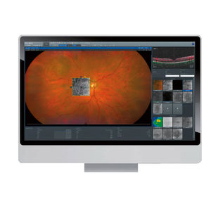 logiciel pour ophtalmologie
