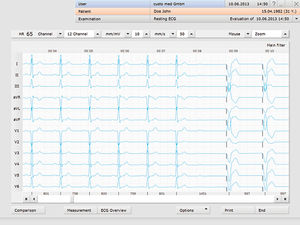 logiciel d'électrocardiographie