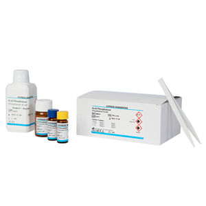 kit de réactifs de phosphatase acide