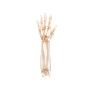 fantôme de test pour radiographie / bras