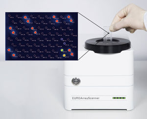 kit de test d'oncologie