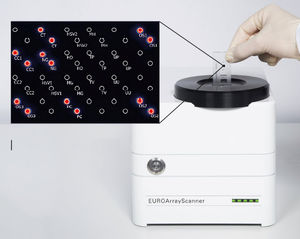 kit de test pour maladies sexuellement transmissibles