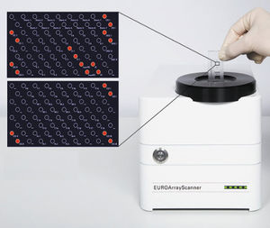 kit de test pour infections dermatologiques