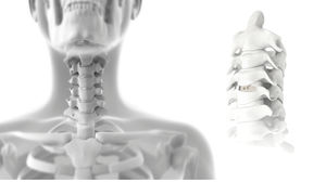 cage intersomatique cervicale