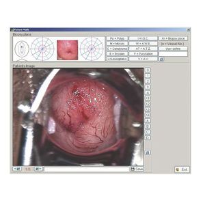 logiciel pour endoscopie