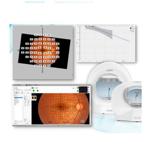 logiciel pour ophtalmologie