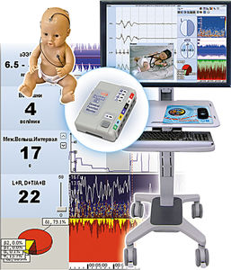 moniteur patient EEG